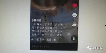 虱子的视频,微观视角下的寄生虫世界